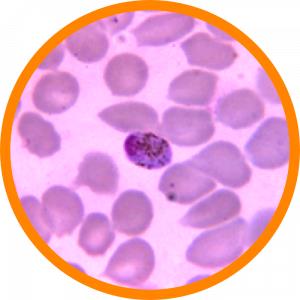 plasmodium malaria U Washington