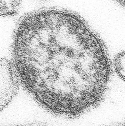 morbilivirus sarampion CDC Cynthia S Goldsmith