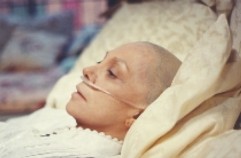 paciente cancer calva