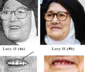 dientes Lucia II detalle