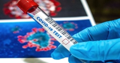 prueba coronavirus COVID 19