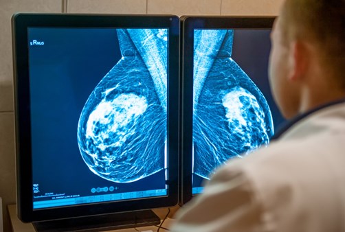 diagnostico imagenes cancer mama
